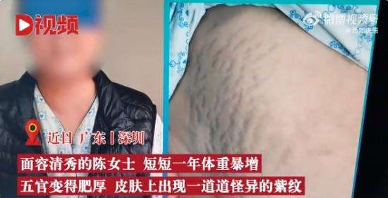 为什么面容突然不能用了-第2张图片-王尘宇